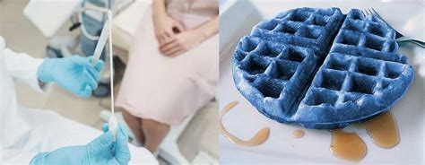 Blue Waffle Infection (Really Gross)